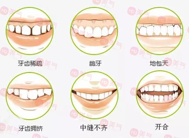 上海九院牙齒正畸哪個(gè)醫(yī)生比較好?楊一鳴、房兵醫(yī)生口碑介紹