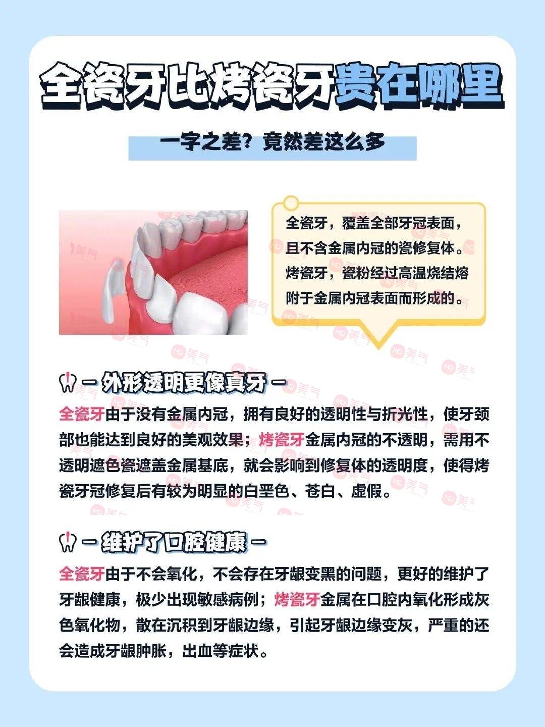 廣州全瓷牙價格多少？2023費用明細(xì)-全瓷牙優(yōu)勢、注意事項附上