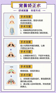 寬鼻梁矯正術(shù)真的有嗎?項(xiàng)目簡介_真實(shí)案例_優(yōu)缺點(diǎn)介紹