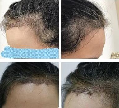 杭州格萊美醫(yī)療美容醫(yī)院怎么樣？