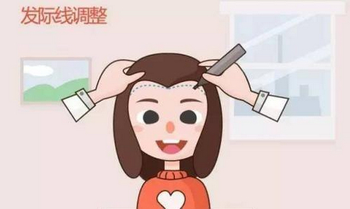 廣州青逸植發(fā)醫(yī)院靠譜嗎？醫(yī)生詳情及頭發(fā)種植案例