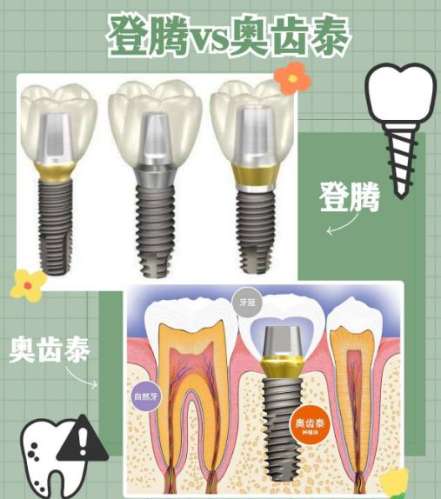 種植牙哪一種品牌最好？介紹10個(gè)比較有名的品牌