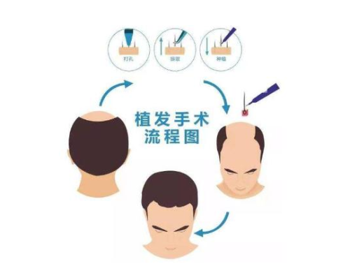 武漢九洲植發(fā)醫(yī)生怎么樣？擁有較高的技術(shù)水平，而且也服務(wù)了眾多的愛(ài)美者