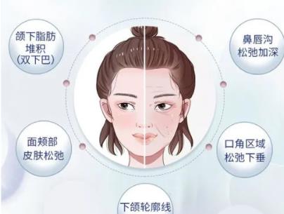 熱拉提hg4.jpg