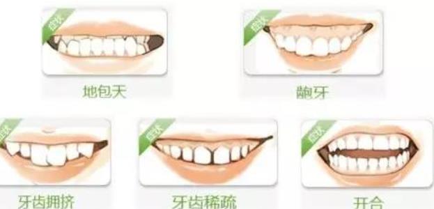 牙齒矯正hg14.jpg