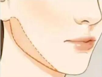 下頜角動(dòng)漫25.jpg