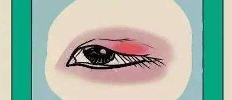 雙眼皮動漫34.jpg