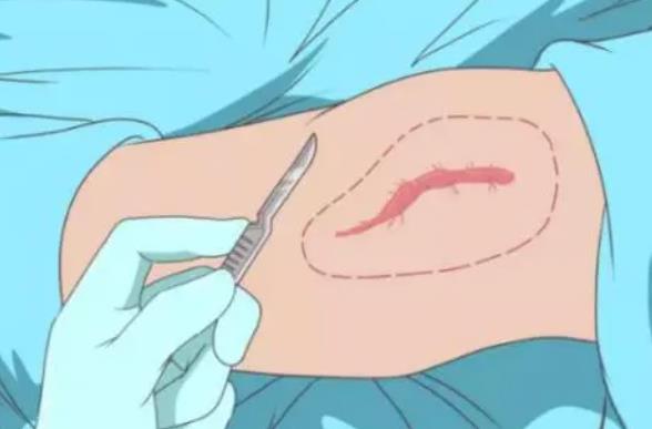 疤痕修復動漫03.jpg