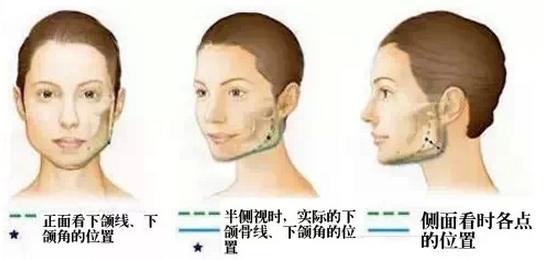 下頜角.jpg