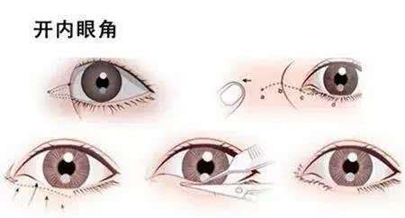u=1665997483,2234857000&fm=26&gp=0.jpg