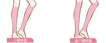 小腿吸脂動漫07.jpg