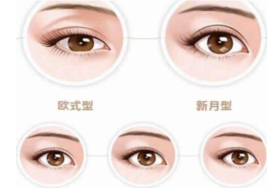 雙眼皮動(dòng)漫hg5.jpg