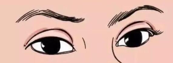雙眼皮動漫22.jpg