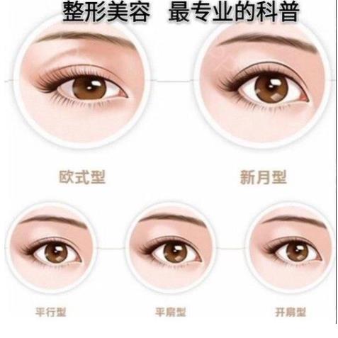 雙眼皮qw3.jpg