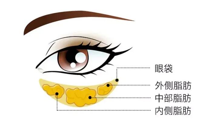 去眼袋動(dòng)漫24.jpg