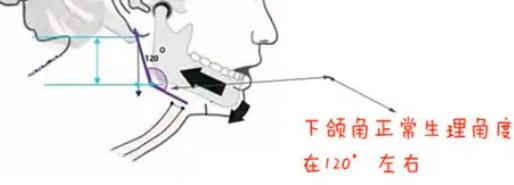 下頜角h25.jpg