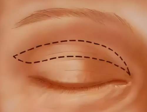 李方奇和王紹國誰的技術(shù)好？一鍵了解兩位醫(yī)生信息