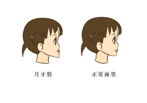 深圳市人民醫(yī)院正頜手術費用需要多少?全新價格表及醫(yī)生信息一覽