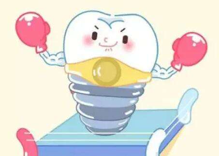 牙齒種植