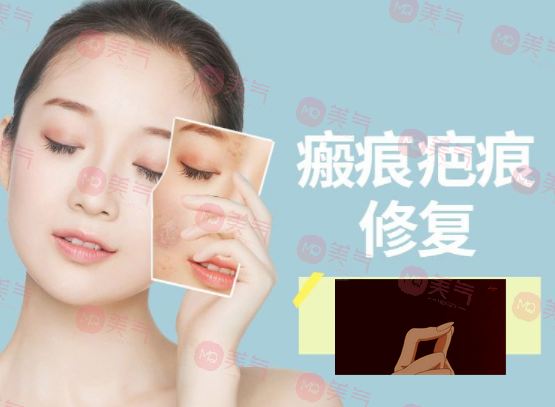 除疤痕最有效的方法，激光治療、碳酸鈣注射、纖維蛋白填充…