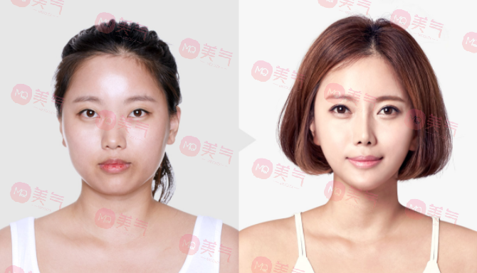 成都友誼醫(yī)院整形科擅長(zhǎng)項(xiàng)目科普