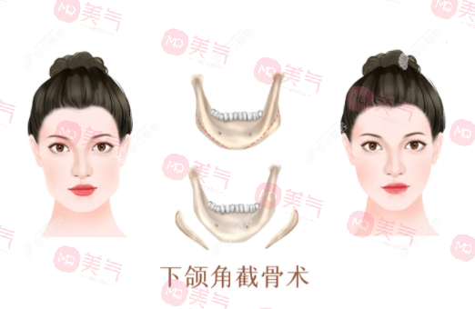 上海首爾麗格醫(yī)療美容醫(yī)院熱門項目