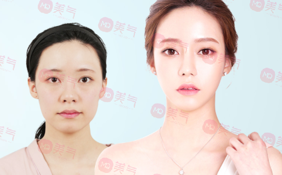 北京八大處整容醫(yī)院做輪廓整形多少錢(qián)？