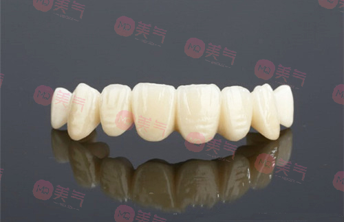 鎳鉻烤瓷牙和鈷鉻烤瓷牙哪個(gè)好，烤瓷牙修復(fù)優(yōu)缺點(diǎn)有哪些？