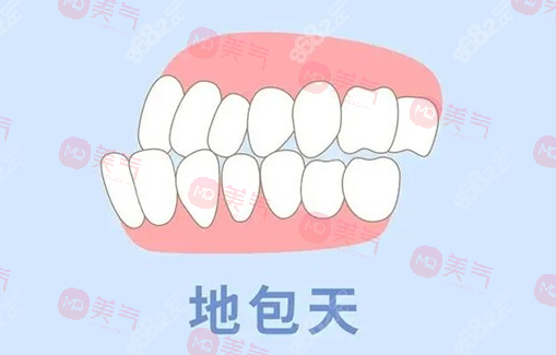 地包天矯正需要多少費(fèi)用？骨性地包天整形費(fèi)用2-4萬(wàn)起