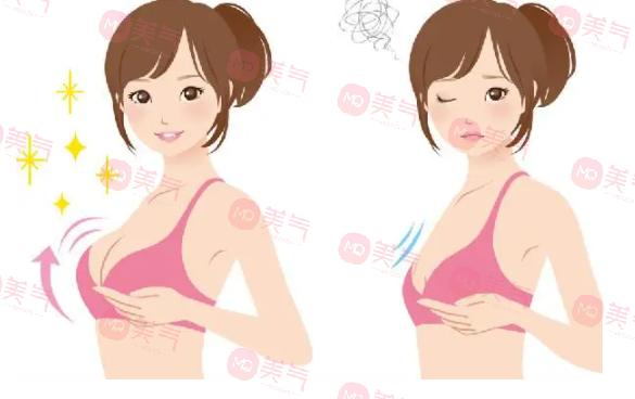 重慶豐胸得多錢？2萬的曼托假體隆胸要不要做
