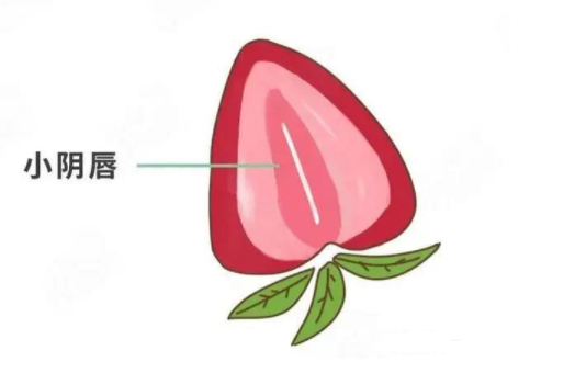 小陰唇整形